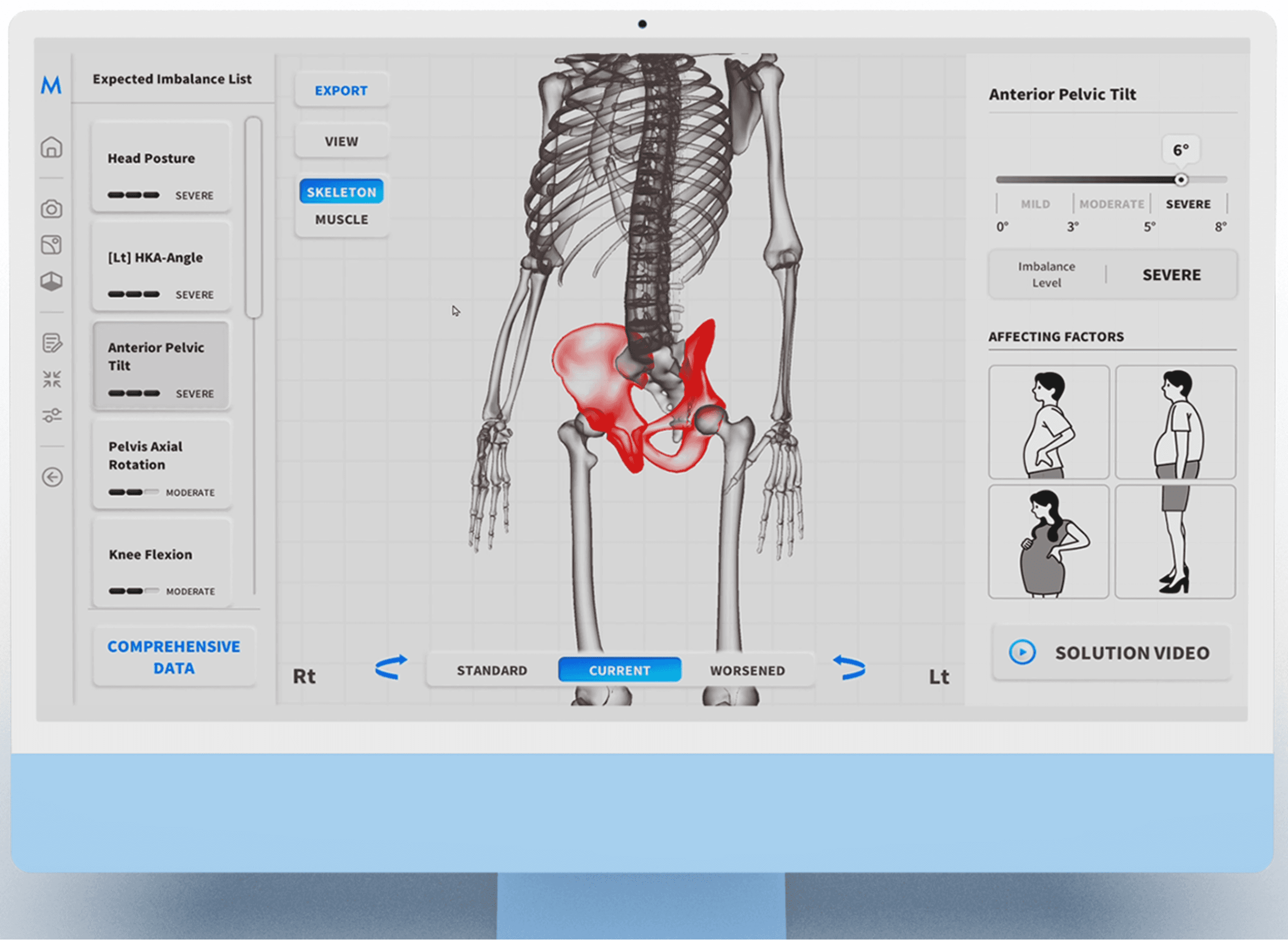 Biomecânica 3D com IA